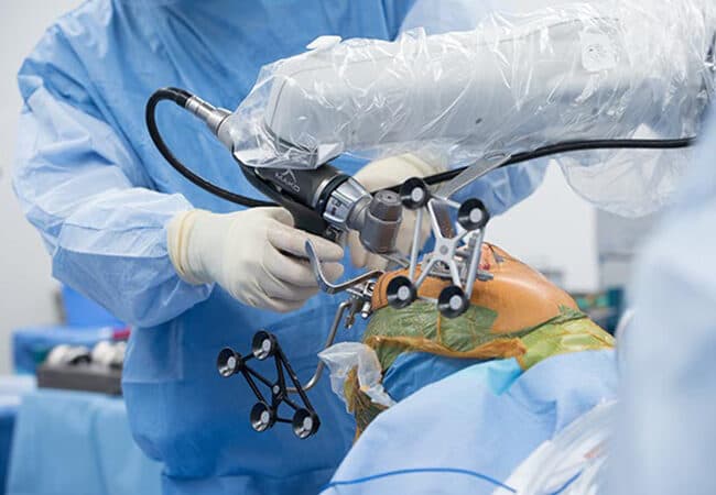 Optical navigation trackers fixed to the knee during robot-assisted surgery